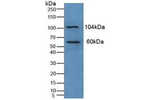 Detection of PKN1 in Human Liver Tissue using Polyclonal Antibody to Protein Kinase N1 (PKN1) (PKN1 抗体  (AA 615-874))