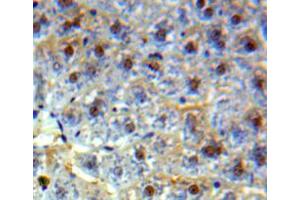 Immunohistochemistry (IHC) image for anti-High Mobility Group Box 2 (HMGB2) (AA 2-187) antibody (ABIN5013695)