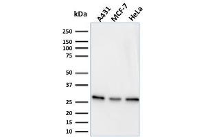 Western Blot Analysis of A431, MCF-7 & HeLa cell lysates using Myofibroblast Marker Mouse Monoclonal Antibody (PR 2D3). (Myofibroblast Marker 抗体)