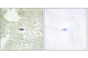 Immunohistochemistry analysis of paraffin-embedded human brain tissue, using TGF beta Receptor II (Phospho-Ser225/250) antibody. (TGFBR2 抗体  (pSer225, pSer250))