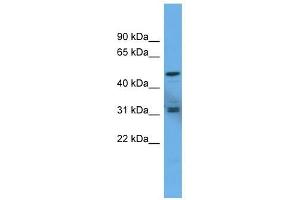 Western Blot showing ADCYAP1R1 antibody used at a concentration of 1-2 ug/ml to detect its target protein. (ADCYAP1R1 抗体  (C-Term))