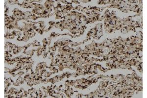 ABIN6264466 and ABIN6272402 at 1/100 staining Human lung tissue by IHC-P.