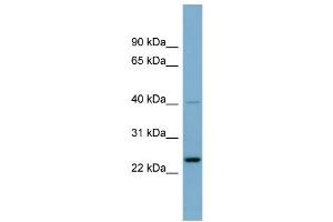 WB Suggested Anti-HSPC111  Antibody Titration: 0. (NOP16 抗体  (Middle Region))