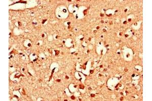 Immunohistochemistry of paraffin-embedded human brain tissue using ABIN7144784 at dilution of 1:100 (Ataxin 1-Like 抗体  (AA 183-463))