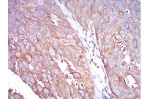 Immunohistochemistry (IHC) image for anti-Tubulin, beta 1 (TUBB1) (AA 33-166) antibody (ABIN5542398)