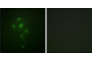 Immunofluorescence analysis of A549 cells, using MSK1 (Phospho-Thr581) Antibody. (MSK1 抗体  (pThr581))