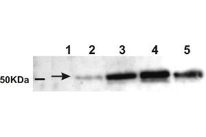Western Blotting (WB) image for anti-Amylase, alpha (AMY) antibody (ABIN619546) (Amylase, alpha 抗体)