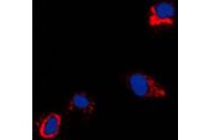 Immunofluorescent analysis of CXADR staining in NIH3T3 cells. (Coxsackie Adenovirus Receptor 抗体  (N-Term))