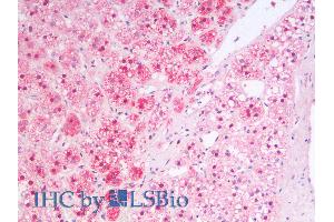 ABIN2613451 (5µg/ml) staining of paraffin embedded Human Adrenal Gland.