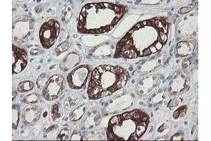 Image no. 3 for anti-Src-like-adaptor 2 (SLA2) antibody (ABIN1500949)