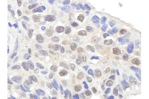 anti-Claspin (CLSPN) (AA 725-775) antibody