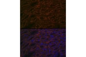 Immunofluorescence (IF) image for anti-beta-Site APP-Cleaving Enzyme 2 (BACE2) (AA 240-470) antibody (ABIN7265880)