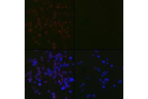 Immunofluorescence (IF) image for anti-Microtubule-Associated Protein 1 Light Chain 3 beta (MAP1LC3B) antibody (ABIN7268519)