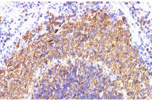 Immunohistochemistry (Paraffin-embedded Sections) (IHC (p)) image for anti-Interleukin 6 Receptor (IL6R) antibody (ABIN7234279)