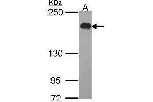 WB Image Sample (30 ug of whole cell lysate) A: Hela 5% SDS PAGE USP47 antibody antibody diluted at 1:1000 (USP47 抗体)