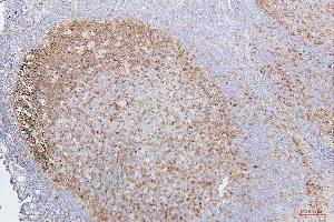 IHC analysis of CDK1 using anti-CDK1 antibody (ABIN7602240). (CDK1 抗体  (AA 66-297))