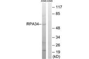 Western blot analysis of extracts from A549 cells, using CD3EAP Antibody. (CD3EAP 抗体  (AA 441-490))