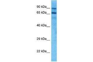 Host:  Mouse  Target Name:  KCND3  Sample Tissue:  Mouse Spleen  Antibody Dilution:  1ug/ml (KCND3 抗体  (C-Term))