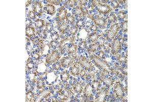 Immunohistochemistry of paraffin-embedded rat kidney using COPS2 antibody at dilution of 1:100 (x400 lens). (COPS2 抗体)