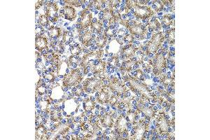 Immunohistochemistry of paraffin-embedded rat kidney using COPS2 antibody at dilution of 1:100 (x400 lens).