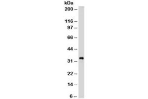 Western blot testing of Jurkat cell lysate with CD99 antibody (clone HO36-1.