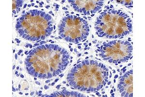 Immunohistochemistry analysis of paraffin-embedded human colon using MUC2 Polyclonal Antibody at dilution of 1:600. (MUC2 抗体)