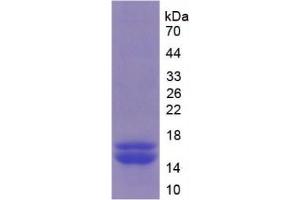 SDS-PAGE of Protein Standard from the Kit (Highly purified E. (FURIN ELISA 试剂盒)