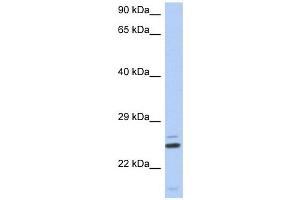 TTC9C antibody used at 1 ug/ml to detect target protein. (TTC9C 抗体  (N-Term))