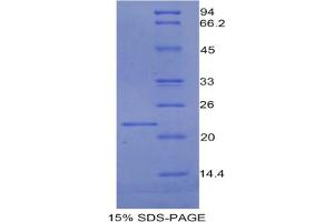 SDS-PAGE analysis of Rat PROCR Protein.