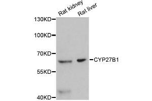 Western blot analysis of extracts of various cell lines, using CYP27B1 antibody (ABIN4903424) at 1:3000 dilution. (CYP27B1 抗体)