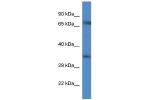 WB Suggested Anti-Slc6a9 AntibodyTitration: 1. (GLYT1 抗体  (C-Term))