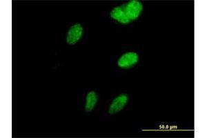 Immunofluorescence of purified MaxPab antibody to SORBS3 on HeLa cell. (Vinexin 抗体  (AA 1-329))