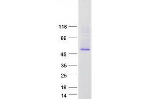 Western Blotting (WB) image for STEAP Family Member 4 (STEAP4) protein (Myc-DYKDDDDK Tag) (ABIN2732842)