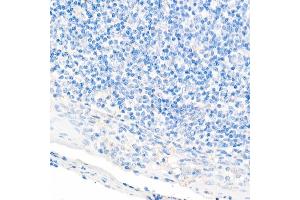 Immunohistochemistry (IHC) image for anti-Caudal Type Homeobox 2 (CDX2) antibody (ABIN7266152)