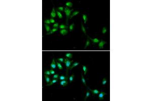 Immunofluorescence analysis of A549 cells using HEXIM1 antibody (ABIN5973397). (HEXIM1 抗体)