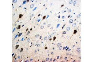 Anti-Neurotrophin 3 antibody, IHC(P) IHC(P): Rat Brain Tissue (Neurotrophin 3 抗体  (Middle Region))