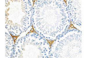 ABIN6264626 and ABIN6276543 at 1/100 staining Rat testis tissue by IHC-P.