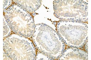 ABIN6264148 and ABIN6279651 at 1/100 staining Rat testis tissue by IHC-P.