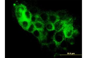 Immunofluorescence (IF) image for anti-Six Transmembrane Epithelial Antigen of The Prostate 1 (STEAP1) (AA 1-339) antibody (ABIN565301)