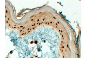 Immunohistochemistry (IHC) image for anti-Transcription Factor AP-2 gamma (Activating Enhancer Binding Protein 2 Gamma) (TFAP2C) (C-Term) antibody (ABIN185355)