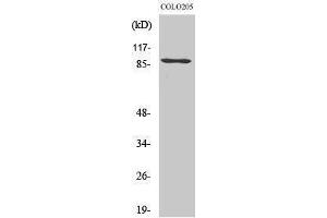 Western Blotting (WB) image for anti-K(lysine) Acetyltransferase 2B (KAT2B) (C-Term) antibody (ABIN3186352)
