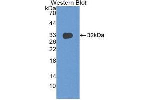 Western Blotting (WB) image for anti-DNA Fragmentation Factor, 45kDa, alpha Polypeptide (DFFA) (AA 51-305) antibody (ABIN3202366) (DFFA 抗体  (AA 51-305))