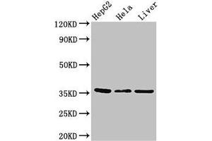 Western Blotting (WB) image for anti-Sprouty Homolog 1, Antagonist of FGF Signaling (SPRY1) (AA 1-178) antibody (ABIN7166148)