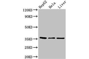 Western Blot Positive WB detected in: HepG2 whole cell lysate, Hela whole cell lysate, Mouse liver tissue All lanes: SPRY1 antibody at 2. (SPRY1 抗体  (AA 1-178))
