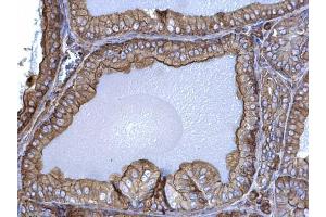Immunohistochemistry (IHC) image for anti-Actin, beta (ACTB) (N-Term) antibody (ABIN2854709)