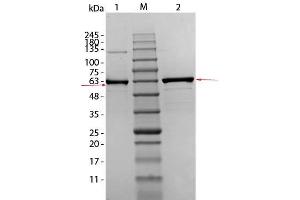 SDS-PAGE of AKT1 (S473A, T308A) Human Recombinant Protein.