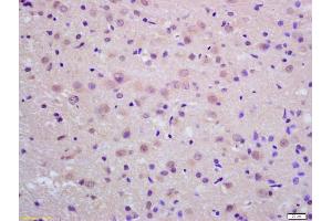 Formalin-fixed and paraffin embedded rat brain labeled with Anti-Neprilysin 2 Polyclonal Antibody, Unconjugated (ABIN1386041) at 1:200 followed by conjugation to the secondary antibody and DAB staining (MMEL1 抗体  (AA 451-550))