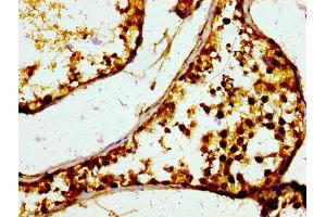 Immunohistochemistry (IHC) image for anti-Macrophage Migration Inhibitory Factor (Glycosylation-Inhibiting Factor) (MIF) (AA 2-115) antibody (ABIN7158882)