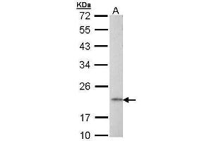 WB Image Sample (30 ug of whole cell lysate) A: Raji 12% SDS PAGE antibody diluted at 1:1000 (AP1S2 抗体  (full length))