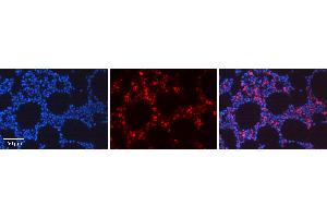 Rabbit Anti-REL Antibody Catalog Number: ARP36966_P050 Formalin Fixed Paraffin Embedded Tissue: Human Bone Marrow Tissue Observed Staining: Nucleus, Cytoplasm Primary Antibody Concentration: 1:100 Other Working Concentrations: 1:600 Secondary Antibody: Donkey anti-Rabbit-Cy3 Secondary Antibody Concentration: 1:200 Magnification: 20X Exposure Time: 0. (c-Rel 抗体  (Middle Region))